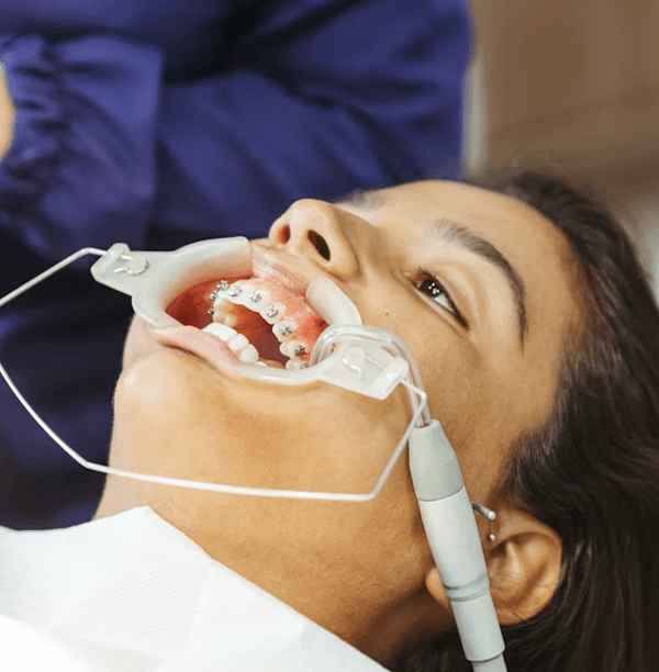 Ortodoncia en adultos: por qué nunca es demasiado tarde para corregir tu sonrisa